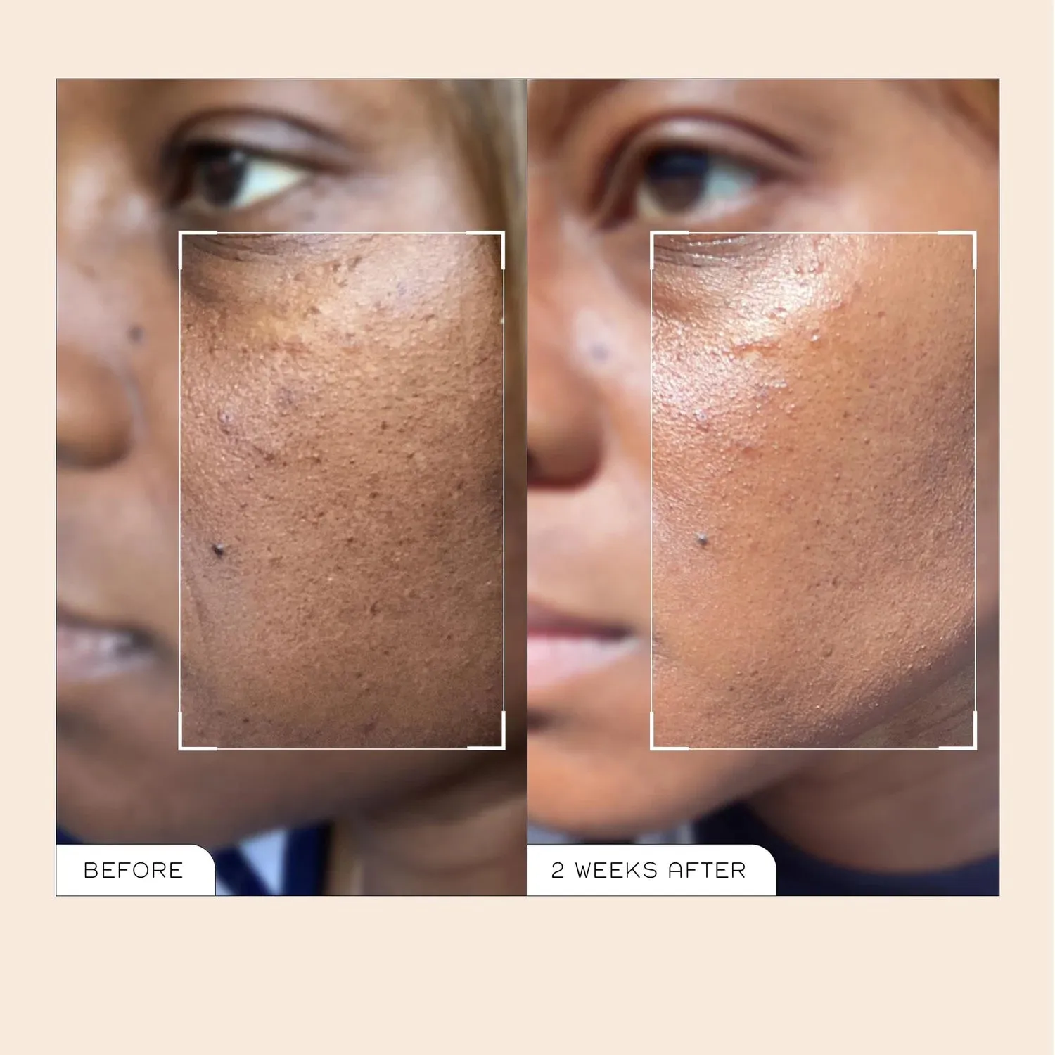 REN Ready Steady Glow Daily AHA Tonic