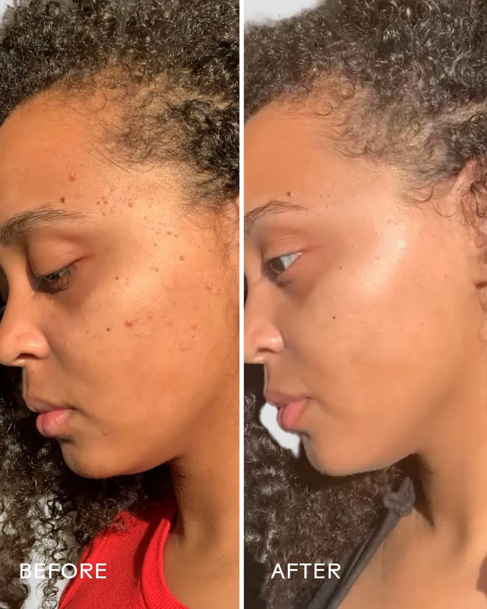 Superfruit Lactic   Multifruit 8% AHA Exfoliating Mask